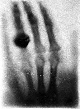 Röntgen, hand